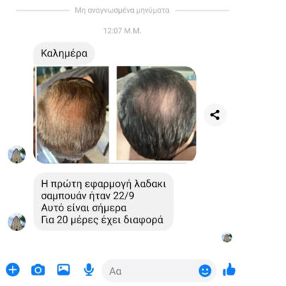 TURBO OIL. Λάδι μαλλιών για τριχόπτωση και ενδυνάμωση - Image 11