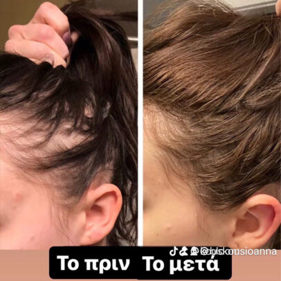 TURBO OIL. Λάδι μαλλιών για τριχόπτωση και ενδυνάμωση - Image 6