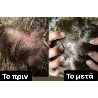 TURBO OIL. Λάδι μαλλιών για τριχόπτωση και ενδυνάμωση - Image 9