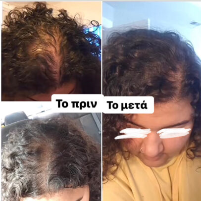 TURBO OIL. Λάδι μαλλιών για τριχόπτωση και ενδυνάμωση - Image 7