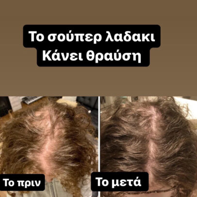 TURBO OIL. Λάδι μαλλιών για τριχόπτωση και ενδυνάμωση - Image 5