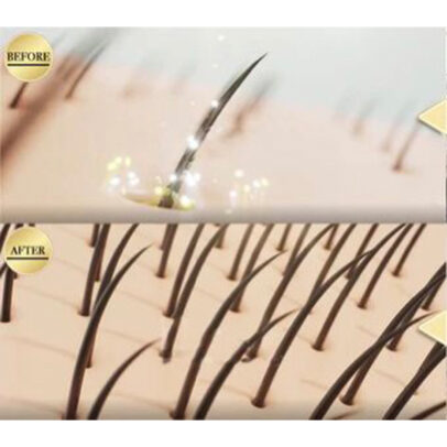 TURBO OIL. Λάδι μαλλιών για τριχόπτωση και ενδυνάμωση - Image 10