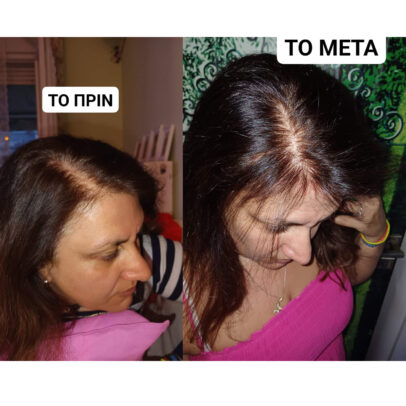 TURBO OIL. Λάδι μαλλιών για τριχόπτωση και ενδυνάμωση - Image 3