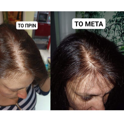 TURBO OIL. Λάδι μαλλιών για τριχόπτωση και ενδυνάμωση - Image 4