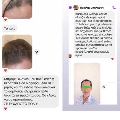 TURBO OIL. Λάδι μαλλιών για τριχόπτωση και ενδυνάμωση - Image 8