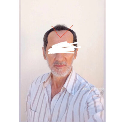 TURBO OIL. Λάδι μαλλιών για τριχόπτωση και ενδυνάμωση - Image 13