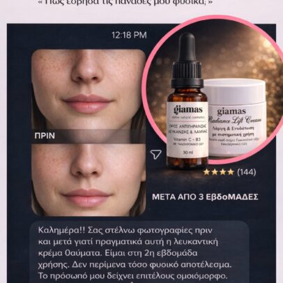 Radiance Lift Cream. Κρεμα πολλαπλής δράσης Άμεση αίσθηση λάμψης. Βελτίωση οψης δυσχρωμιών. Πιο λεία και φωτεινή επιδερμίδα. Φουλ αντιγήρανση - Image 9