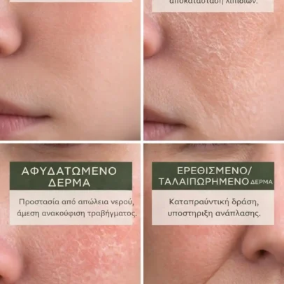 Λίπος- κρέμα εντατικής  αντιγήρανσης, σύσφιξης και θρέψης με λανολίνη & πρόβειο λίπος - Image 4