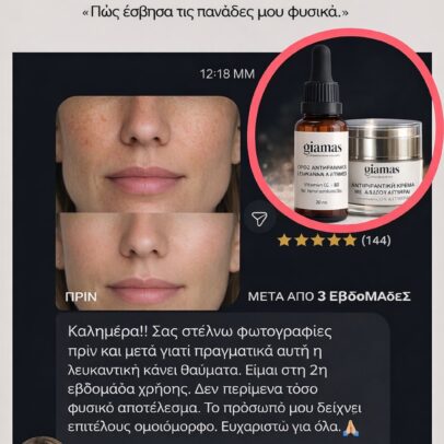 Κρεμα με 4 φυτικα βλαστοκύτταρα με γλυκολικο οξύ - Image 7