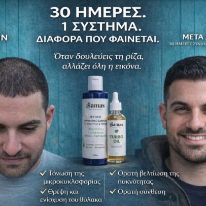 Σετ Κατά της Τριχόπτωσης – Φυτικό Δυναμωτικό Σαμπουάν & Turbo Oil - Image 2